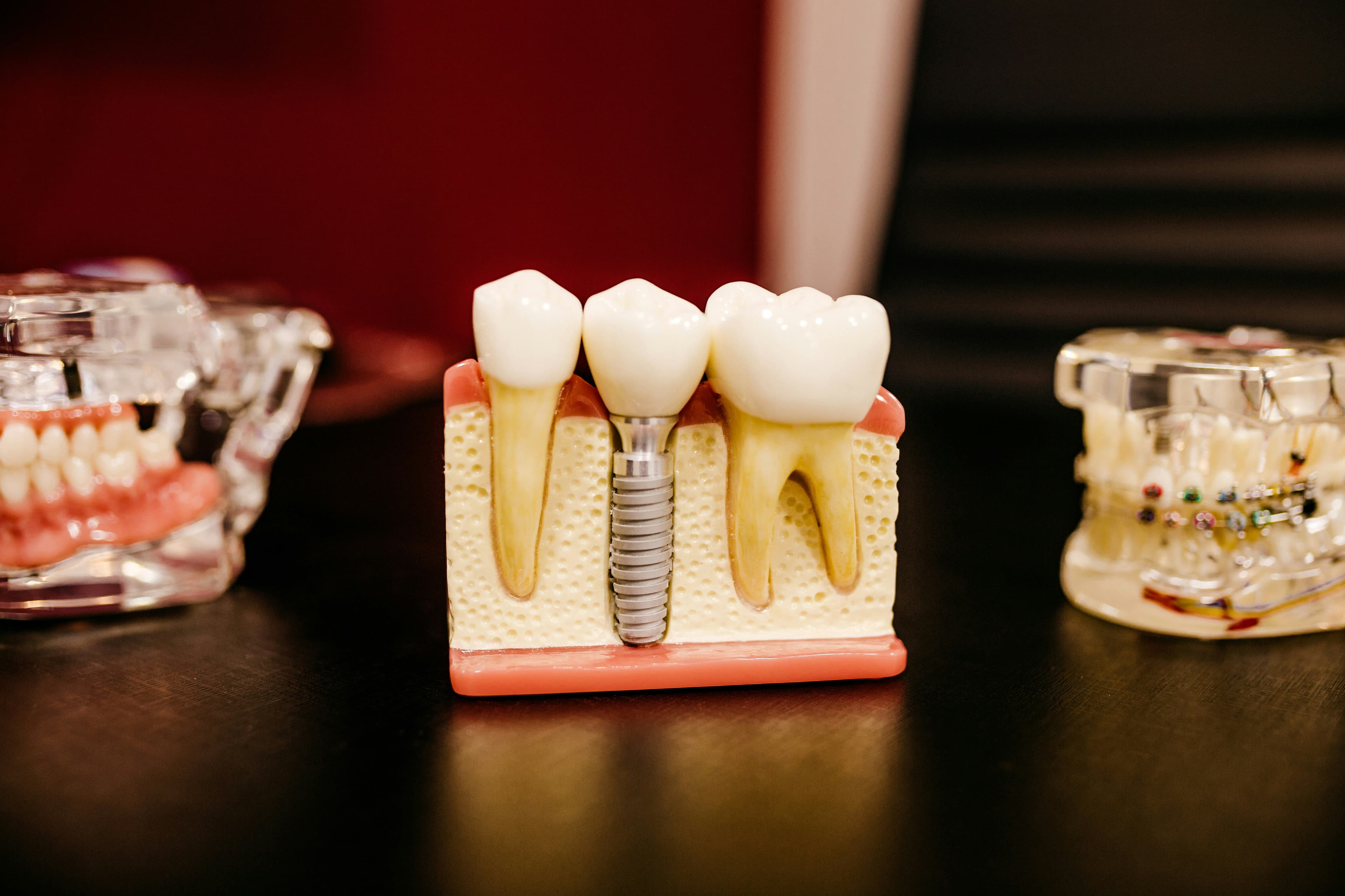 Dentist assessing a loose implant restoration or veneer