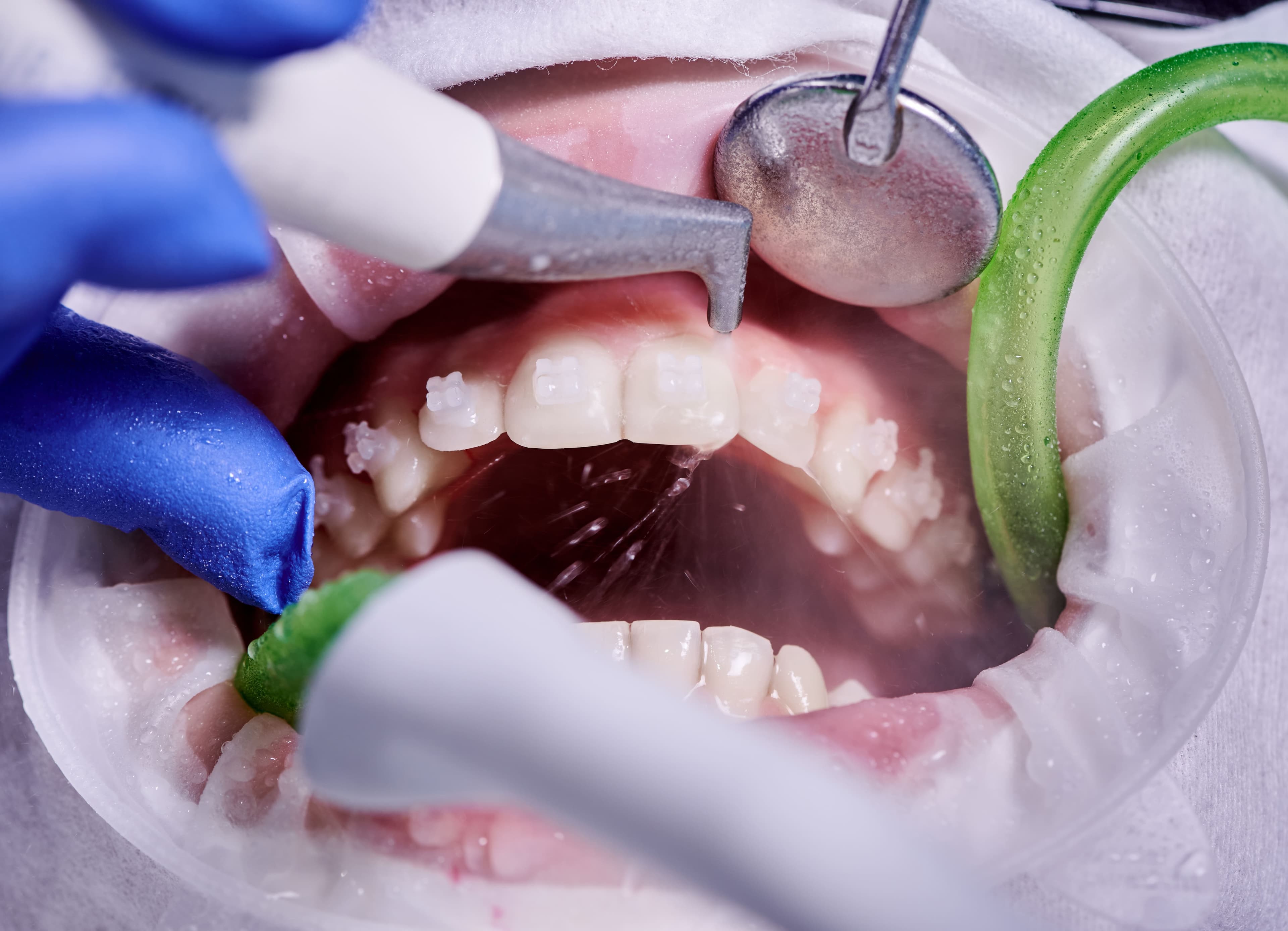 Dental clinician carrying out a routine examination