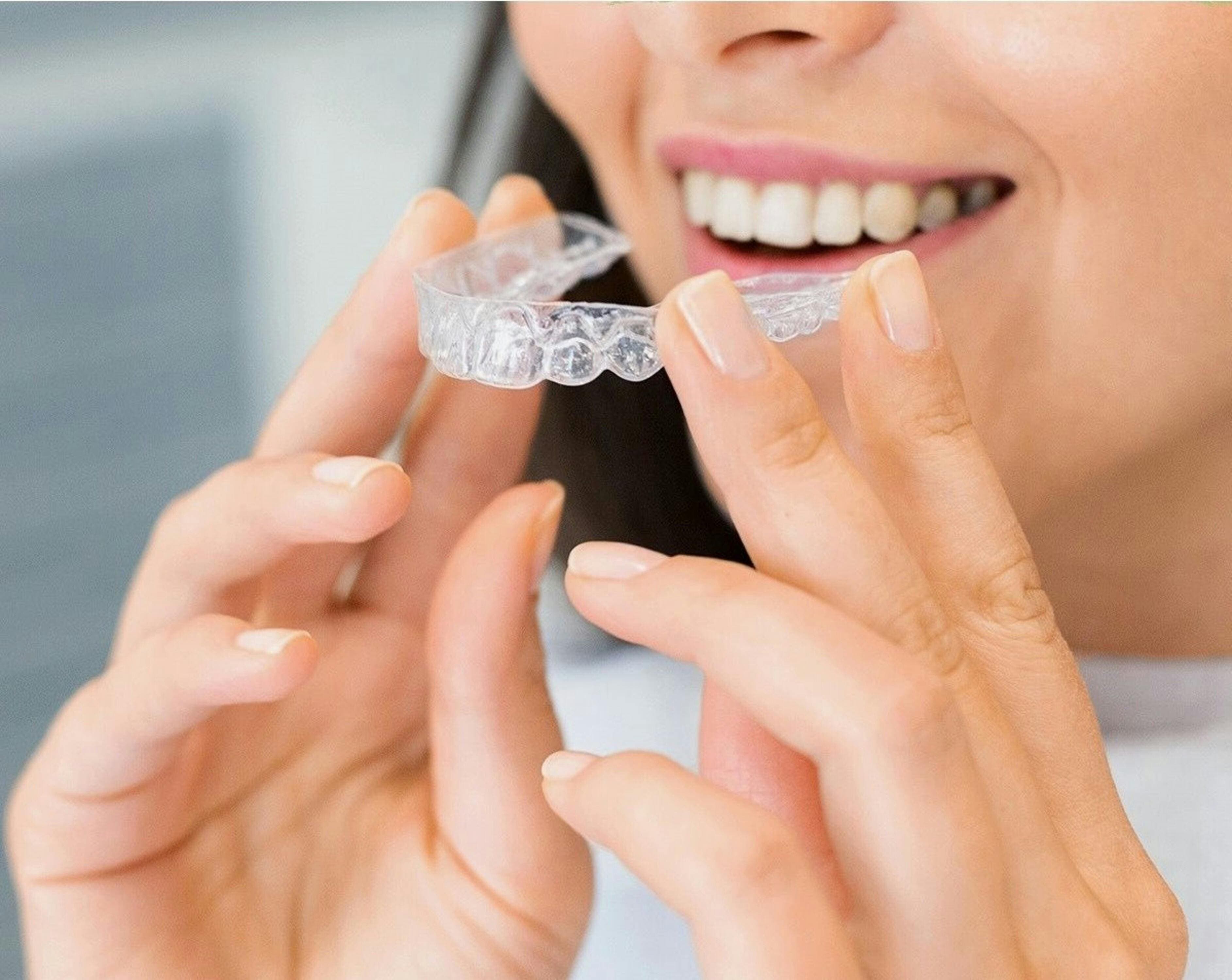 Clear dental aligners held in a treatment setting