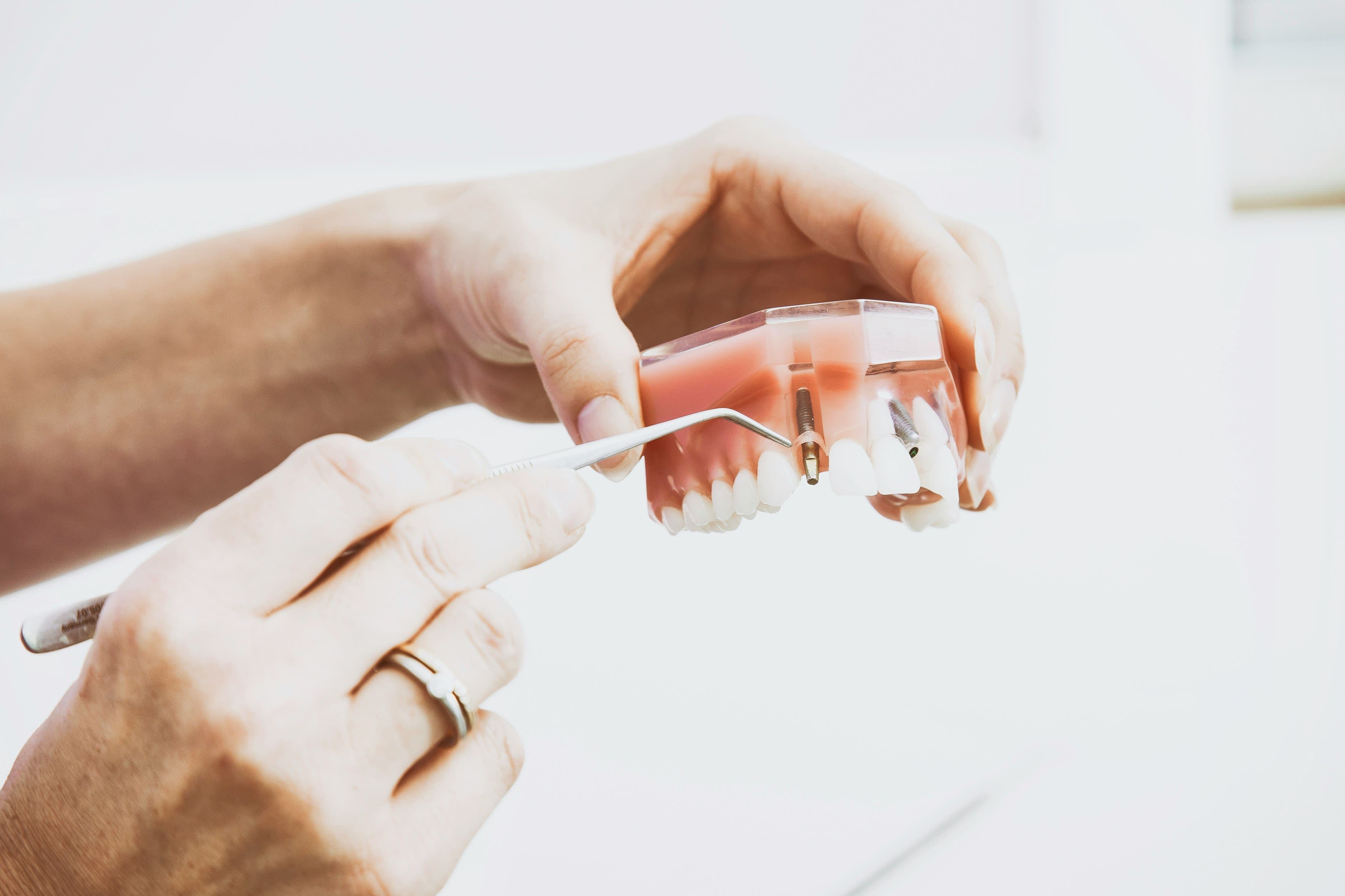 Dental professional planning implant treatment with a patient