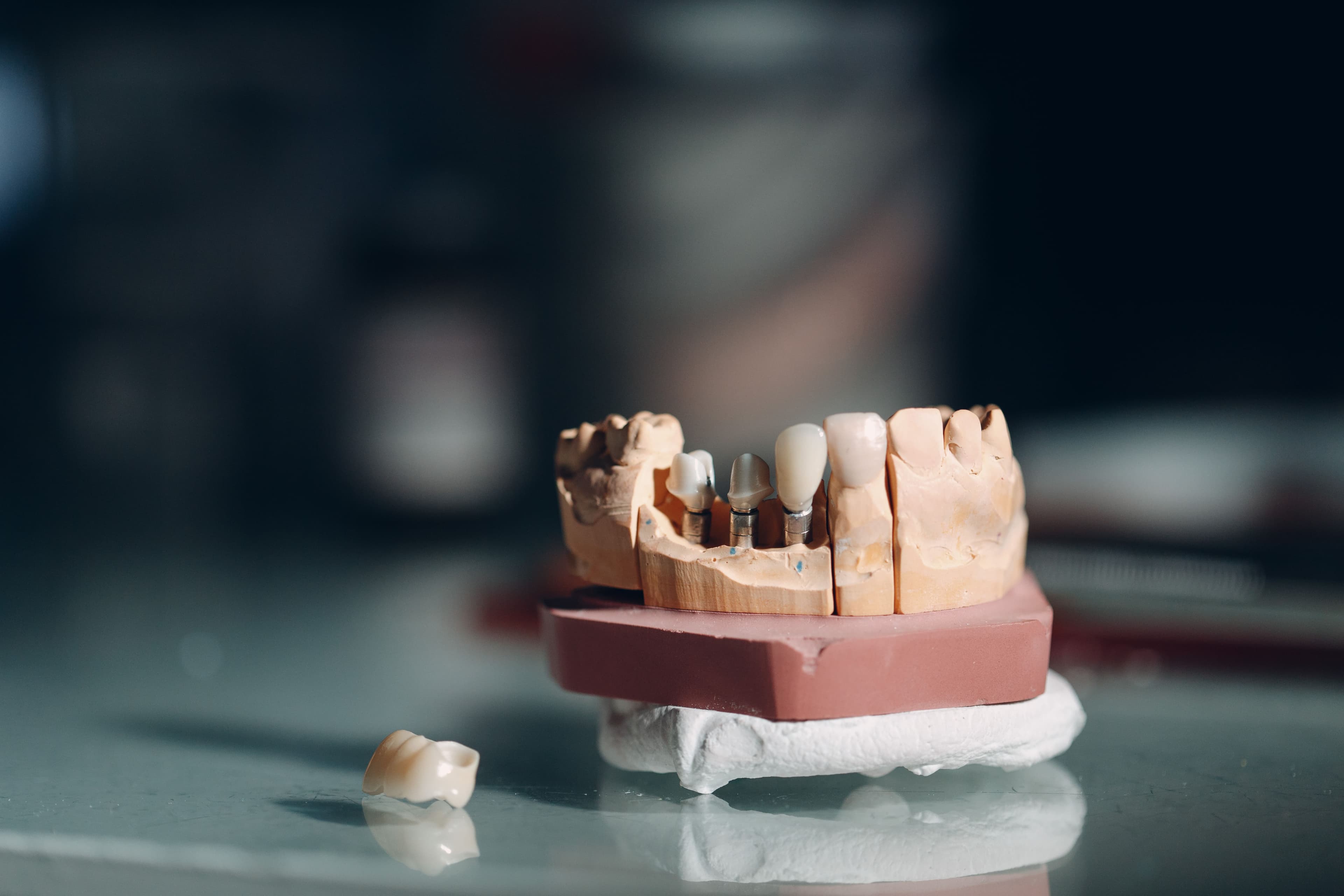 Clinician planning dental implant treatment