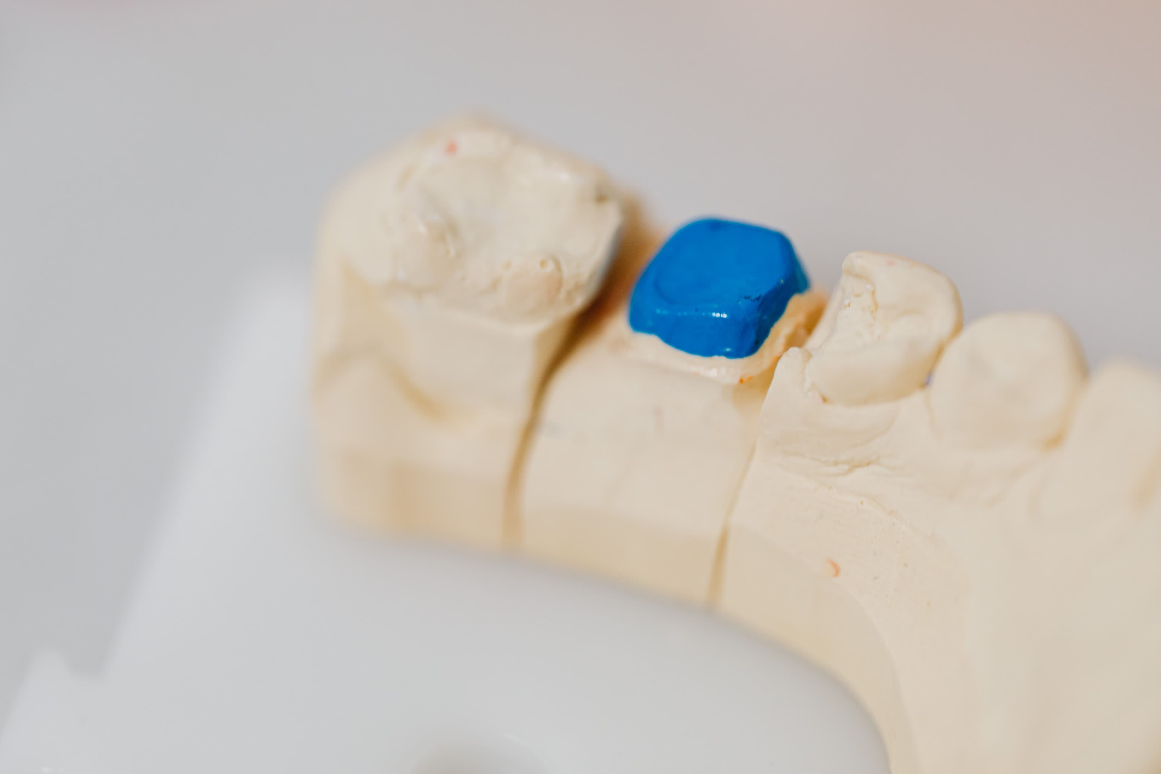 Dentist preparing restorative treatment for a patient