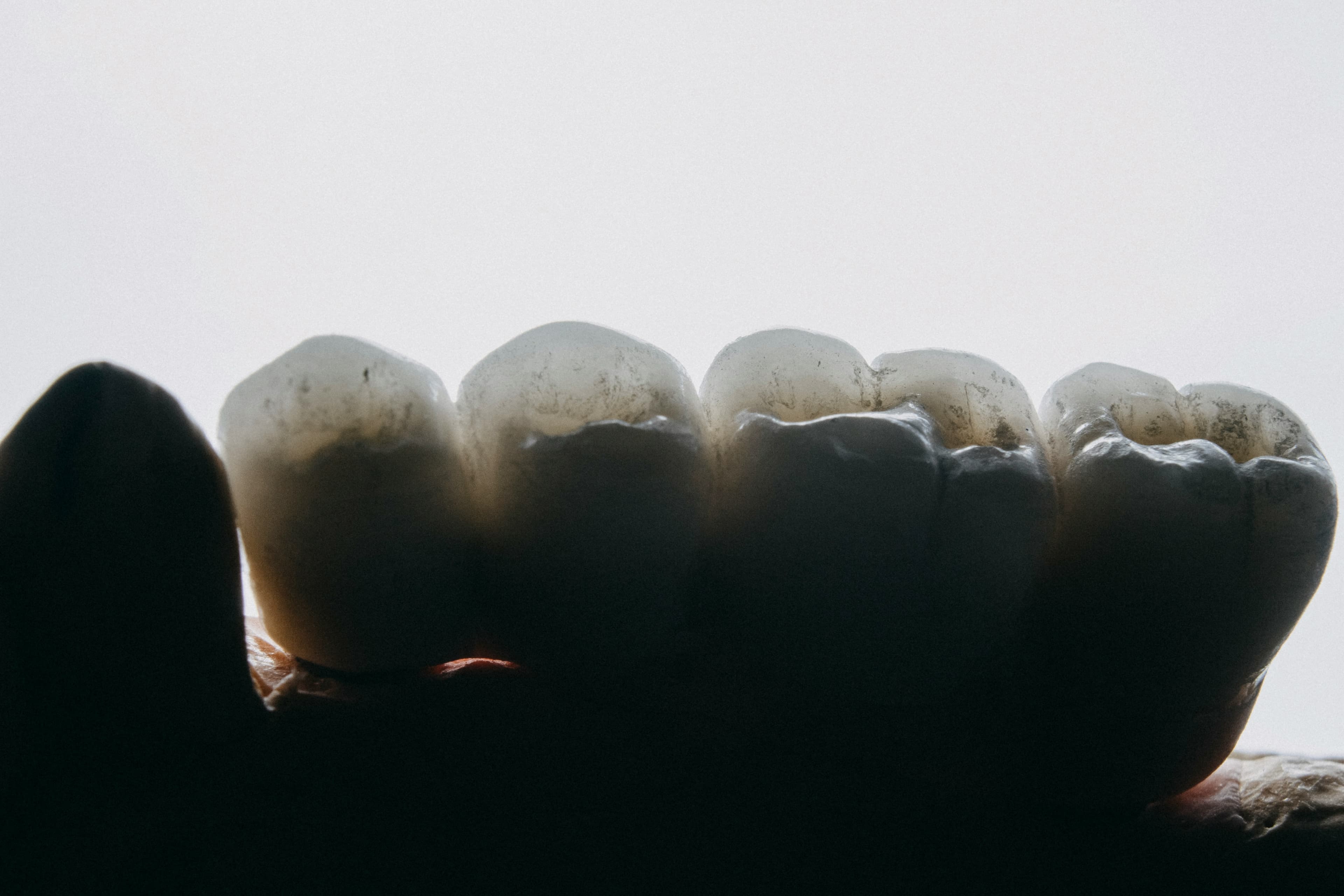 Dentist assessing a patient before a tooth extraction